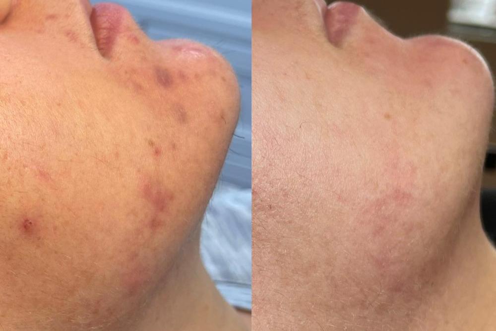 before and after