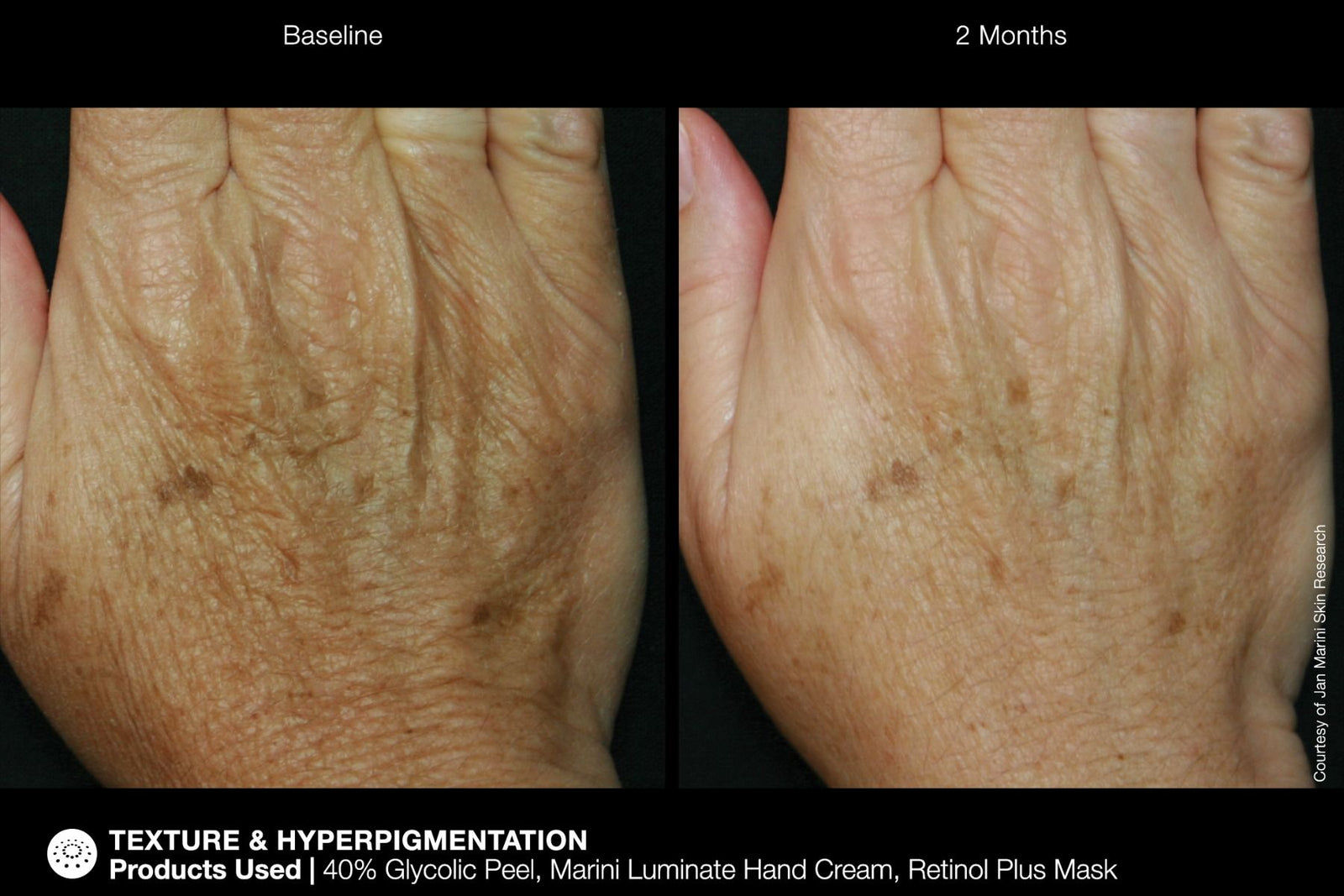 JM ReNu Corrective Hand Cream