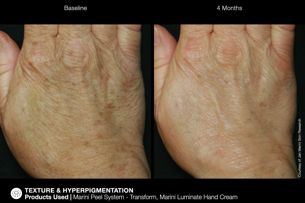 JM ReNu Corrective Hand Cream