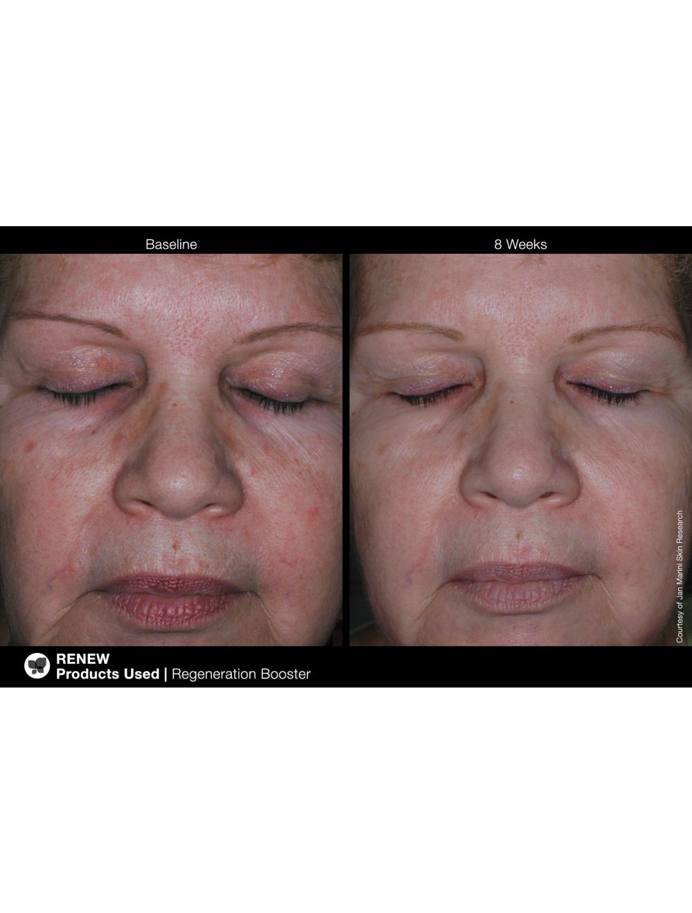 JM Regeneration Booster