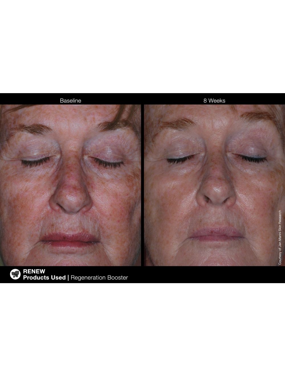 JM Regeneration Booster